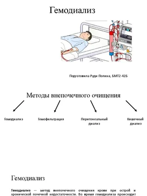 Гемодиализ можно делать в ближайшей к вам больнице - заявление от НСЗУ |  РБК Украина