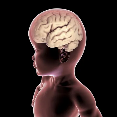 Гидроцефалия головного мозга (водянка) - что это такое, лечение, симптомы,  причины
