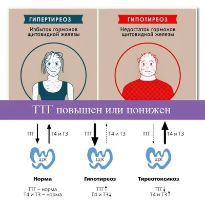 Причины, симптоматика и способы лечения гипотиреоза и гипертиреоза | Ольвица