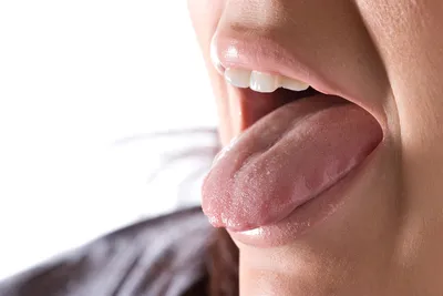 Глоссит языка: лечение, причины, препараты от глоссита