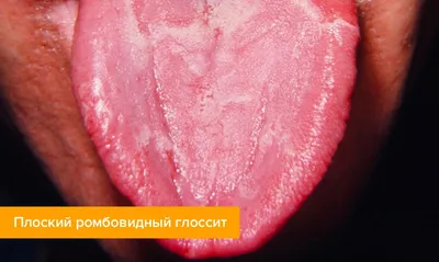 Статьи о здоровье полости рта — советы по уходу за зубами и деснами |  Dental-MM