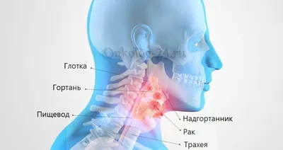 Диагностика и лечение заболеваний горла в СЗАО (м.Щукинская, м.Стрешнево,  м.Сокол)