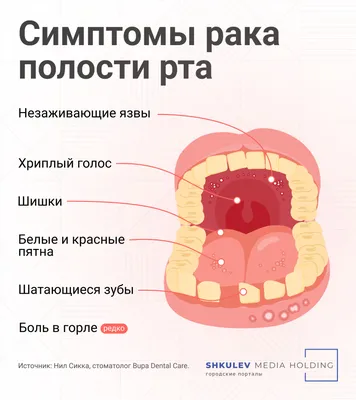 Белый налет в горле чем лечить, налет на слизистой горла без температуры,  причины — блог Фурасол®