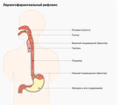 Спрей для горла на водной основе \"Цикламен, алоэ, эвкалипт, мята\". Снятие  воспаления слизистой, 30 мл.