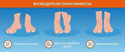 Vegapharm Tajikistan - Грибковые заболевания занимают первое место среди  инфекций. Грибковые заболевания кожи (микозы) — это инфекционные заболевания,  вызванные болезнетворными грибами. Микозы заразны, возбудители заболевания  передаются при ...