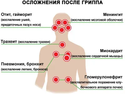 Профилактика гриппа, острых респираторных инфекций (ОРВИ) | Cmr55