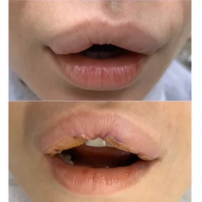 Женские губы в шоколаде с каплей стоковое фото ©belchonock 55307493