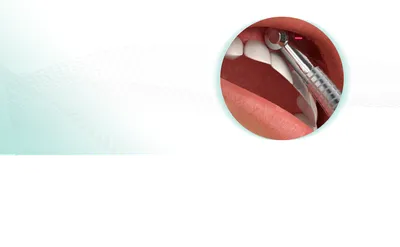 Пухлые губы: как легко и быстро придать губам объем?