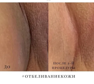 Беспощадный одесский загар своих интимных мест показала самая сексуальная  девушка Молдовы