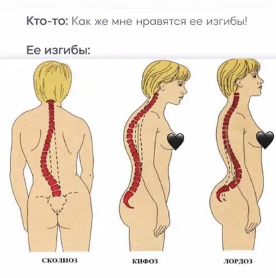 Искривление позвоночника - сколиоз