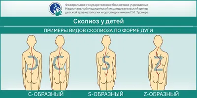 Сколиоз позвоночника: причины, степени искривления, современные методы  лечения и профилактика