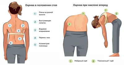 Лечение искривления позвоночника в Одессе - оздоровительный центр  Евминов–Кудряшова