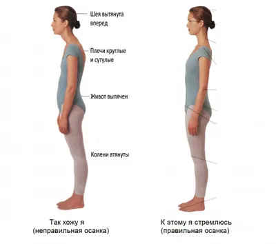 Как определить искривление позвоночника