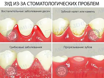 Почему чешутся правая и левая рука - что прогнозируют - приметы | OBOZ.UA