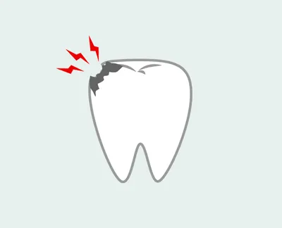 Глубокий кариес: симптомы и методы лечения зубов препаратами