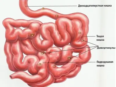 Как почистить кишечник и не навредить себе - Лайфхакер