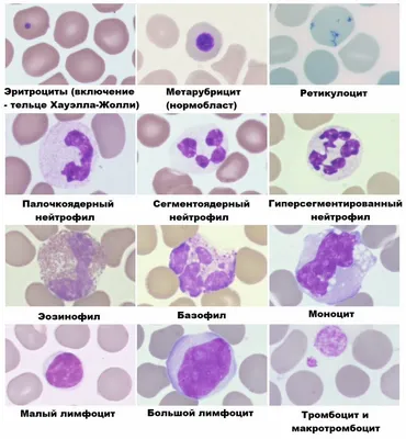 Клетки крови человека, изображённые на рисунке: обеспечивают иммунитет.  имеют двояковыпуклую форму. участвуют в транспорте кислорода. обеспечивают  свёртывание крови. не содержат ядра. несут железо в составе... |  Яндекс.Репетитор | ЕГЭ-2020 по биологии