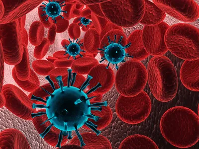 Миелопролиферативные заболевания - Eesti Leukeemia- ja Lümfoomihaigete Liit