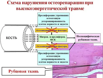 Химическая И Клеточные Факторы, Участвующие В Воспалительной Реакции На  Повреждение Ткани И Клеток Крови Repair.white Слипания. Фотография,  картинки, изображения и сток-фотография без роялти. Image 49472798