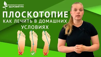 5 простых упражнений от Плоскостопия на каждый день! - YouTube