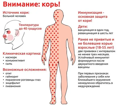 Корь: меры профилактики » Официальный портал мэрии города Черкесска