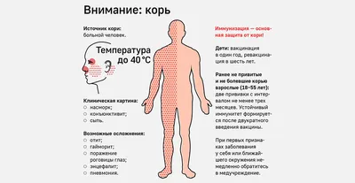 Непривитый от кори рискует на всю жизнь остаться с воспалением мозга