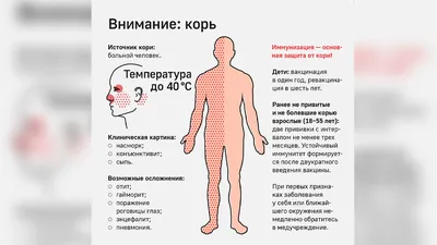 ВОЗ: смертность от кори в 2022 году выросла в мире более чем на 40% -  16.11.2023, Sputnik Беларусь