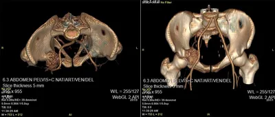 Рентгенография костей таза. | Портал радиологов