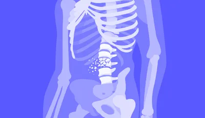 Кости ног человека 3D модель - Скачать Анатомия на 3DModels.org