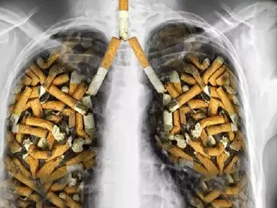 АО «МСК «НОВЫЙ УРЕНГОЙ» - Курение и как бросить эту вредную привычку