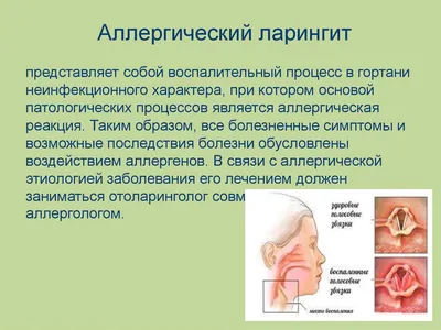 Ларингит - это не просто охриплость голоса