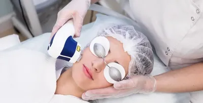 ᐅ Лазерная эпиляция лица в Одессе ᐊ Цены и отзывы на эпиляцию волос на лице  лазером в клинике Аура