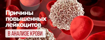 Признаки снижения лейкоцитов после химиотерапии 🏥 Статьи онкоцентра София