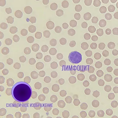 Лейкоциты — белая гвардия армии крови. Эти клетки выполняют три важные  задачи: 1️⃣ вырабатывают антитела.. | ВКонтакте