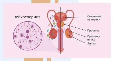 Почему у меня понижены лейкоциты в крови: что это значит – отвечает  иммунолог | О здоровье: с медицинского на русский | Дзен