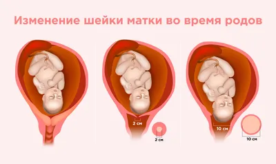 Как делать массаж промежности перед родами? Масло для массажа -  А.Дунаевская - YouTube