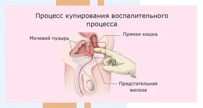 Массаж простаты в Москве: цены на лечебный массаж простаты в клинике  АльтраВита