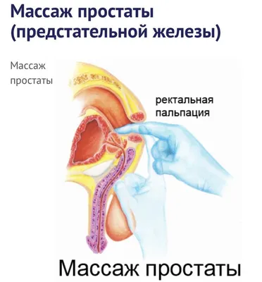 Массаж мумужчинам, массаж простаты. - Массаж Кайтпас на Olx