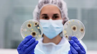 Учёные наглядно показали, сколько микробов скапливается на украшениях —  Ferra.ru