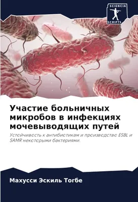 Новый метод борьбы с микробами: ученые разработали эффективное  антибактериальное покрытие. Читайте на UKR.NET