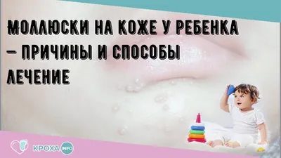 внешние кожные заболевания. сыпь на коже человека в виде родинок бородавки  и папилломы Стоковое Фото - изображение насчитывающей стационар, моль:  223428612