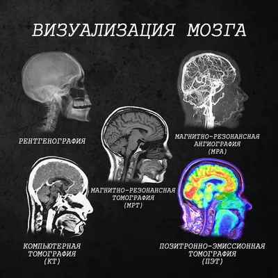 Магнитно-резонансная томография (МРТ)