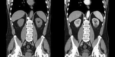 МРТ брюшной полости в Москве, сделать магнитно-резонансную томографию  брюшной полости