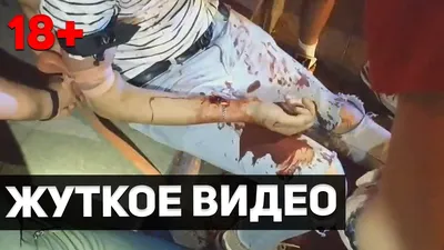 В Николаеве парень пытался порезать вены: полиции удалось его отговорить |  СВІДОК.info