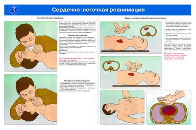 ПРАВИЛА И ТЕХНИКА ПРОВЕДЕНИЯ ИСКУССТВЕННОГО ДЫХАНИЯ И НЕПРЯМОГО МАССАЖА  СЕРДЦА