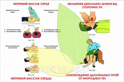 Аппарат непрямого массажа сердца AutoPulse (id 69451923), купить в  Казахстане, цена на Satu.kz