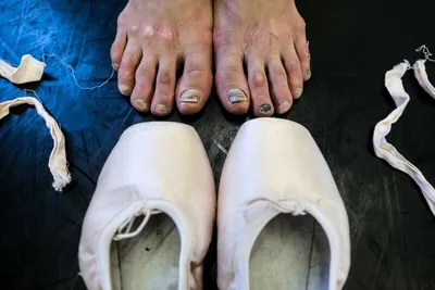 Правда о ножках балерин. Мифы, реальность и фотографии.