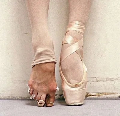 Talumala and Tameorg - Ноги настоящей балерины выглядят именно так. А не  как у Волочковой в раскорячку. | Facebook
