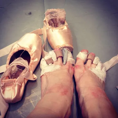 Ножки балерины....Вот тебе и «эфирный» полёт на сцене, пируэты и восхищение  зрителей. Огромный и тяжкий труд. | ВКонтакте
