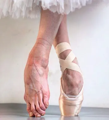 Почему у балерин растут косточки на ногах? | Всем балет! | Дзен